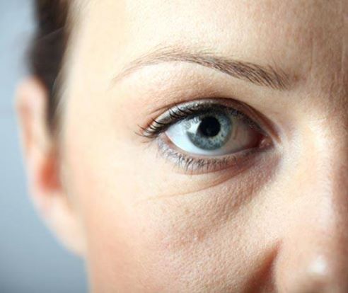 Первые признаки старения-морщины под глазами. 